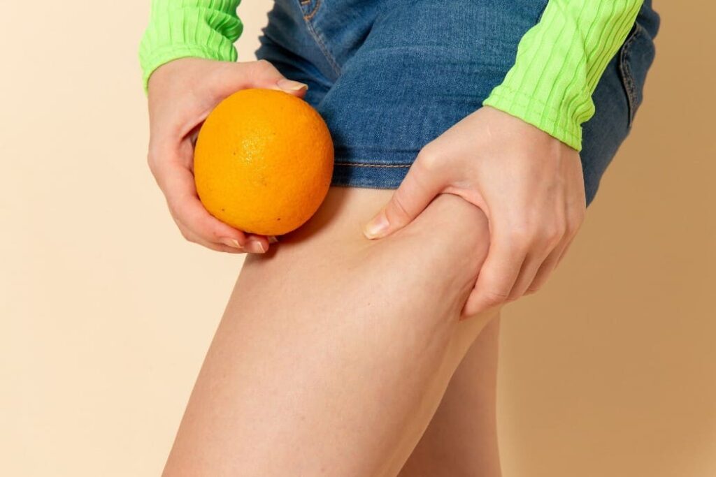 Diferencia entre piel de naranja y celulitis