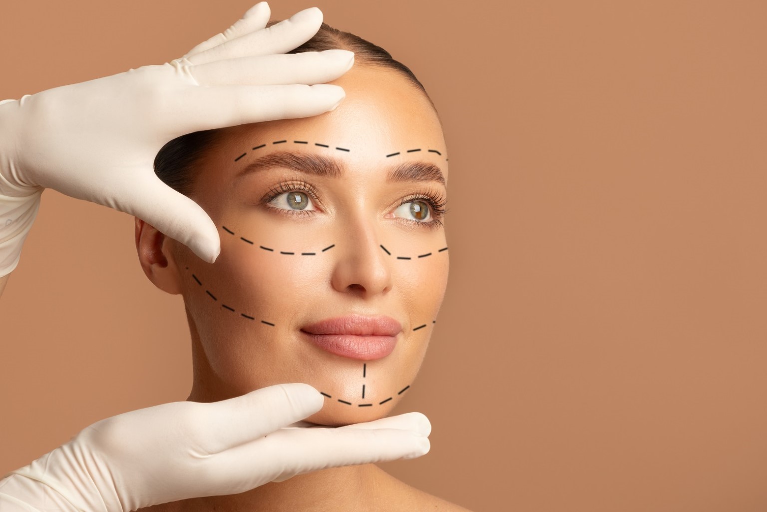 Armonización facial en Benidorm - líneas